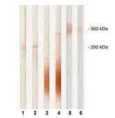 Anti-PAPP A antibody [18A10] used in Western Blot (WB). GTX10196